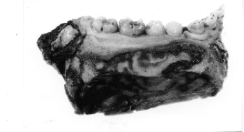 BONE, mandible